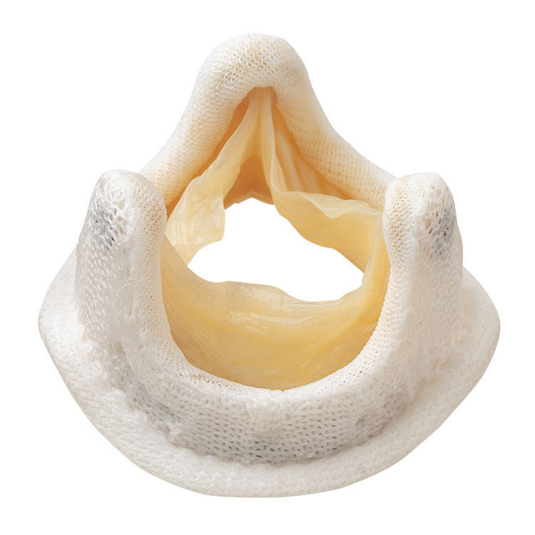 valve-02 Tissue Valve