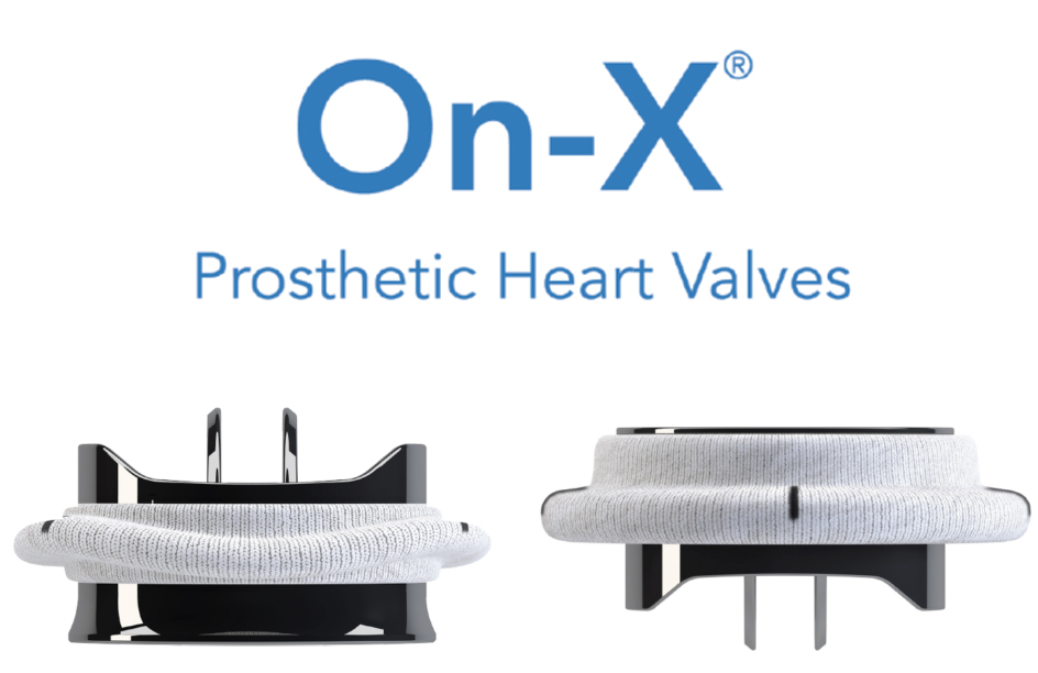 ON-x-header-980x506-02 - Heart Valve Choice